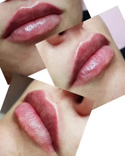 Art Lashes - kosmetologia estetyczna - powiekszanie ust.